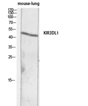 CD158e rabbit pAb