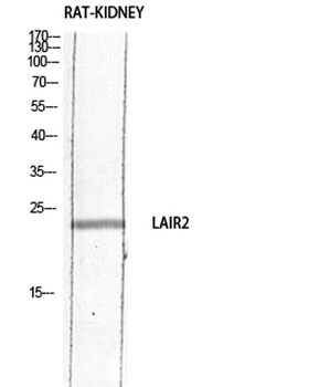 CD306 antibody