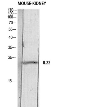IL22 antibody