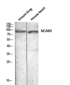 CD56 antibody