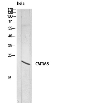 CMTM8 rabbit pAb