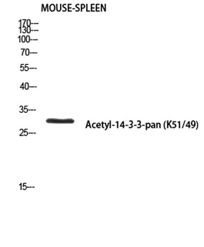 14-3-3-pan (Acetyl Lys51/49) antibody