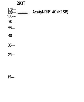 RIP140 (Acetyl Lys158) rabbit pAb