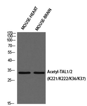TAL1/2 (Acetyl Lys221/Acetyl Lys222/Acetyl Lys36/Acetyl Lys37) rabbit pAb