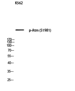 Atm (phospho-Ser1981) antibody
