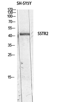 SSTR2 antibody