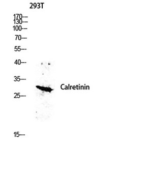 Calretinin antibody