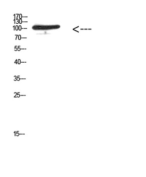 MER/TYRO3 (Phospho-Tyr753/Tyr685) rabbit pAb