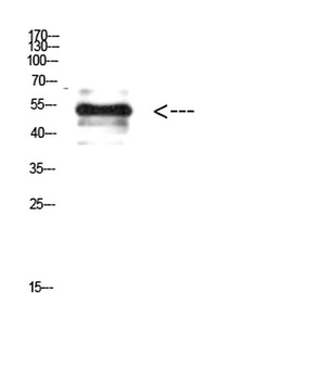 Vimentin (Phospho-Tyr38) antibody