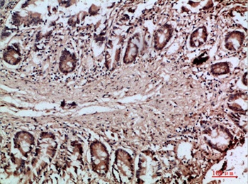 Villin rabbit pAb Antibody
