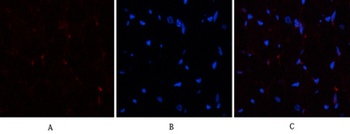 PTEN antibody