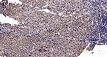 MUM1 rabbit pAb Antibody