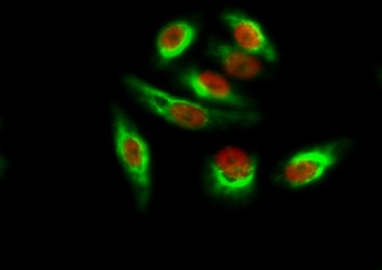 Amyloid-beta antibody