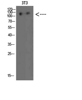 Hamartin rabbit pAb Antibody