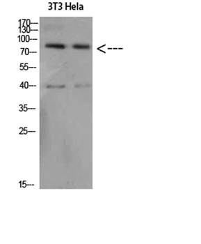 Amyloid-beta antibody