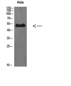 ETBR antibody