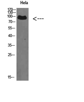 VPS35 rabbit pAb Antibody