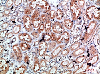 Perforin 1 rabbit pAb Antibody