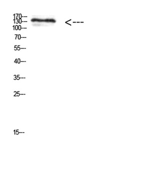 MIB1 antibody