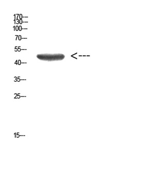 Cytokeratin 14/17 rabbit pAb Antibody