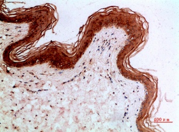 Cytokeratin 14/17 rabbit pAb Antibody