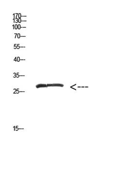 MYOZ2 rabbit pAb Antibody