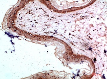 COL17A1 rabbit pAb Antibody