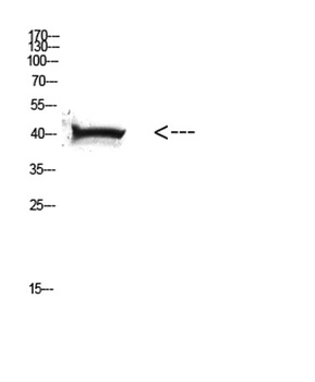 HLA Class I rabbit pAb Antibody
