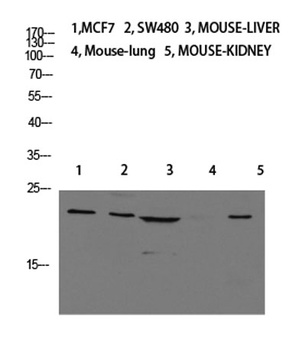 Calcitonin antibody