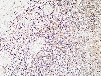 Calcitonin rabbit pAb Antibody