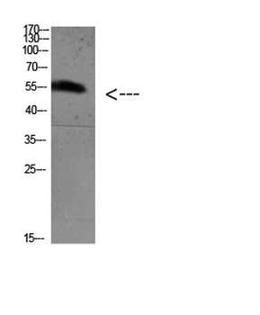 FoxO4 (Acetyl Lys189) antibody