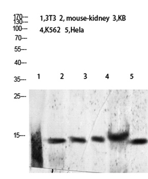 Histone H2B (Acetyl Lys24/25) rabbit pAb Antibody