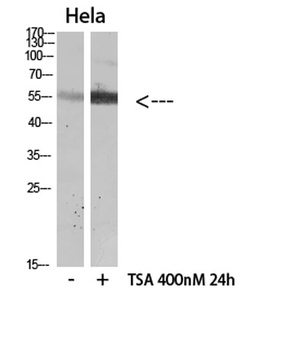 HNF-4α (Acetyl Lys106) rabbit pAb