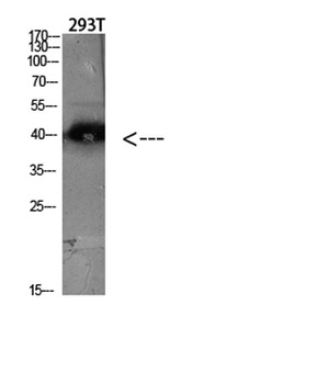 CKR-5 antibody