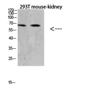 RANK antibody