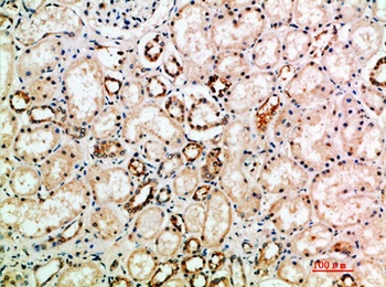 NT-3 antibody