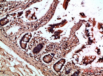 OSM rabbit pAb Antibody