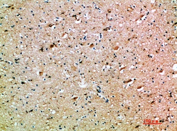 OSM rabbit pAb Antibody