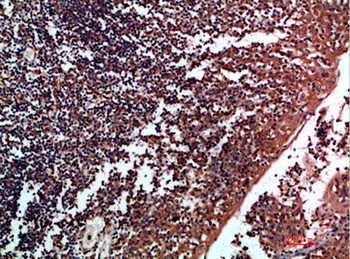 Tenascin-R antibody