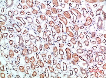 CD1B antibody