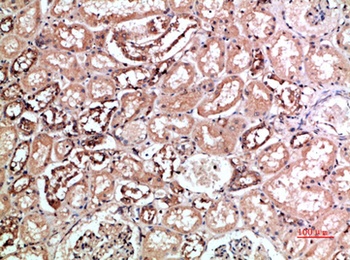 CD158f1/2 antibody