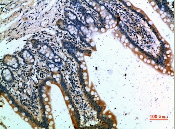 CKR-1 rabbit pAb