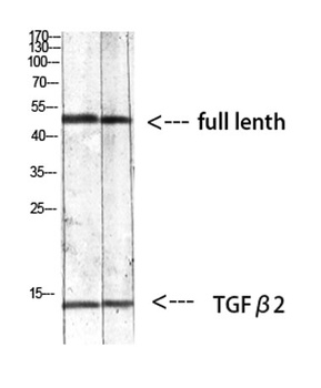 TGFbeta2 antibody