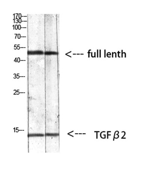 TGFβ2 rabbit pAb
