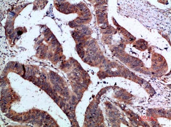 IL-1F7 rabbit pAb Antibody