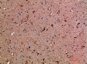 NNT-1 rabbit pAb