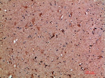 NNT-1 antibody