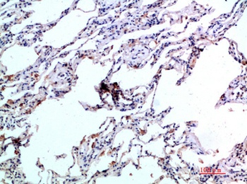 Eotaxin-2 antibody