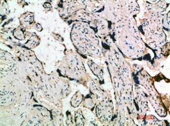 Inhibin α rabbit pAb