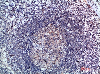 6CKine antibody